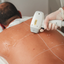 Men's Laser Hair Removal